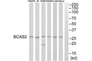 Western blot analysis of extracts from HeLa cells, HepG2 cells, Huvec cells, A549 cells, K562 cells and Jurkat cells, using BCAS2 antibody. (BCAS2 antibody  (C-Term))