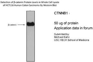 CTNNB1 antibody - N-terminal region (P100600_T100) validated by WB using HCT116 cell lysate CTNNB1 is supported by BioGPS gene expression data to be expressed in HCT116 (CTNNB1 antibody  (N-Term))