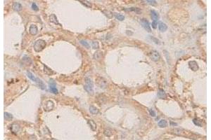 Immunohistochemical staining of formalin-fixed paraffin-embedded rat kidney tissue with PLXNB1 polyclonal antibody  at 1 : 100 dilution.