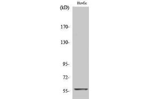 Western Blotting (WB) image for anti-Myc Proto-Oncogene protein (MYC) (C-Term) antibody (ABIN3179963) (c-MYC antibody  (C-Term))