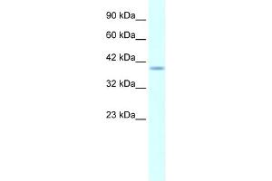 WB Suggested Anti-HMX1 AntibodyTitration: 5. (HMX1 antibody  (Middle Region))