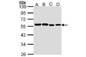 WB Image Sample (30 ug of whole cell lysate) A: A431 , B: H1299 C: Hela D: Hep G2 , 10% SDS PAGE antibody diluted at 1:1000 (TRF1 antibody  (C-Term))