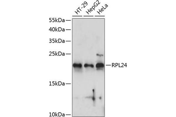 RPL24 抗体  (AA 38-157)
