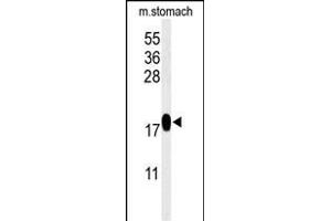 Western blot analysis of TXNDC12 Antibody (C-term) (ABIN651065 and ABIN2840056) in mouse stomach tissue lysates (35 μg/lane). (TXNDC12 antibody  (C-Term))