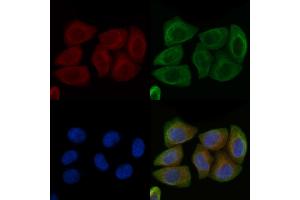 ABIN6261379 and ABIN6266779 staining Hela cells by IF/ICC.