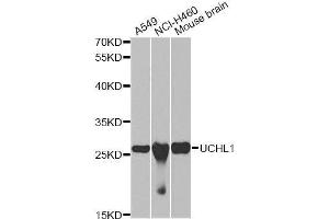 Western blot analysis of extracts of various cell lines, using UCHL1 antibody. (UCHL1 antibody  (AA 59-223))