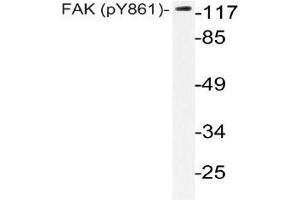 Western blot (WB) analysis of p-FAK antibody in extracts from HeLa cells. (FAK antibody  (pTyr861))