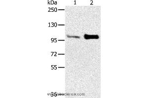 Western blot analysis of Mouse muscle and heart tissue, using ACTN2 Polyclonal Antibody at dilution of 1:300 (ACTN2 antibody)