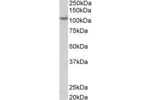 Western Blotting (WB) image for anti-Thyroid Peroxidase (TPO) (C-Term) antibody (ABIN2464934) (Thyroperoxidase antibody  (C-Term))