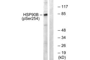 Western blot analysis of extracts from Hela cells treated with TNF- alpha (10ng/ml, 30mins), using HSP90B (phospho-Ser254) antibody. (HSP90AB1 antibody  (pSer254))