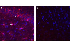 Expression of IBA1/AIF1 in rat hippocampusImmunohistochemical staining of perfusion-fixed frozen rat brain sections with Guinea Pig Anti-IBA1/AIF1 Antibody (ABIN7581823), (1:1000), followed by donkey anti-guinea pig-biotin and Streptavidin-Cy3. (Ionized Calcium-binding Adapter Molecule 1 (IBA1) Peptide)