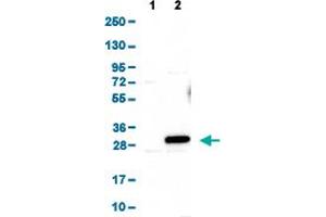 Western Blot analysis of (1) Negative control (vector only transfected HEK293T lysate), and (2) Over-expression lysate (Co-expressed with a C-terminal myc-DDK tag (~3. (ARL6 antibody  (AA 92-184))