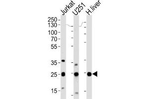 Western Blotting (WB) image for anti-Glutathione S-Transferase mu 1 (GSTM1) antibody (ABIN3002864) (GSTM1 antibody)