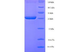 SDS-PAGE (SDS) image for Phospholysine Phosphohistidine Inorganic Pyrophosphate Phosphatase (LHPP) (AA 1-270), (full length) protein (His-SUMO Tag) (ABIN4975529) (LHPP Protein (AA 1-270, full length) (His-SUMO Tag))