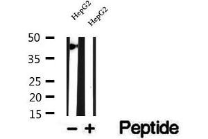 Western blot analysis of extracts of HepG2 cells, using SMYD3 antibody. (SMYD3 antibody  (N-Term))