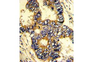 Immunohistochemistry (IHC) image for anti-Epsin 3 (EPN3) antibody (ABIN3002666) (EPN3 antibody)