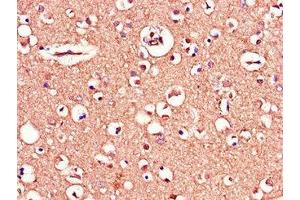 Immunohistochemistry of paraffin-embedded human brain tissue using ABIN7159770 at dilution of 1:100 (MAPT antibody  (AA 33-166))
