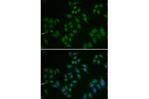 Immunofluorescence (IF) image for anti-Tumor Protein P63 (TP63) (AA 421-680) antibody (ABIN6219346)