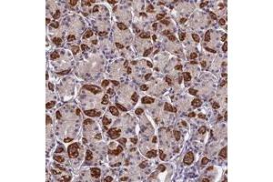 Immunohistochemical staining of human stomach with PLAC9 polyclonal antibody  shows strong cytoplasmic positivity in parietal cells at 1:500-1:1000 dilution. (PLAC9 antibody)