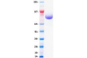 Western Blotting (WB) image for Epidermal Growth Factor Receptor (EGFR) protein (DYKDDDDK-His Tag) (ABIN2720014)