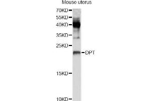 Western blot analysis of extracts of mouse uterus, using DPT Antibody (ABIN5995761) at 1/1000 dilution.