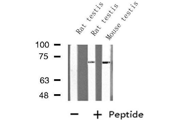 Ubiquilin 3 antibody  (Internal Region)