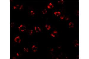 Immunofluorescence of SPT2 in 3T3 cells with SPT2 Antibody at 20 µg/ml. (SPTLC2 antibody  (C-Term))