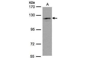 WB Image Sample(30 μg of whole cell lysate) A:HeLa S3, 7. (USP11 antibody  (N-Term))