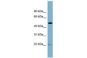 UCHL5IP antibody used at 1 ug/ml to detect target protein.