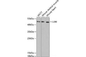 Western blot analysis of extracts of various cell lines using LUM Polyclonal Antibody at dilution of 1:1000. (LUM antibody)