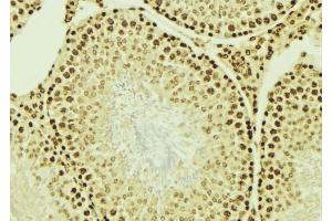 ABIN6276701 at 1/100 staining Mouse testis tissue by IHC-P. (IGF2BP1 antibody  (N-Term))
