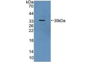 Antizyme Inhibitor 1 antibody  (AA 5-290)