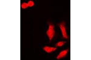 Immunofluorescent analysis of HCCR-1 staining in MCF7 cells. (LETMD1 antibody)
