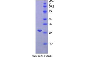 SDS-PAGE analysis of Human FGF13 Protein.