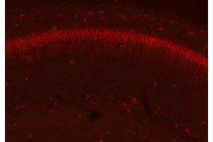 Adult WT and KO mouse hippocampus immunofluorescence with N206A/8 (green) and KC rabbit anti- Kv2. (GFAP antibody  (AA 411-422))
