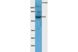 Rat brain lysates probed with Anti-SNX1 Polyclonal Antibody (ABIN682078) at 1:200 in 4 °C. (Sorting Nexin 1 antibody  (AA 401-522))