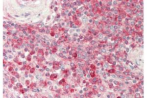Rabbit Anti-PTDSS1 antibody  Formalin Fixed Paraffin Embedded Tissue: Human Spleen Primary antibody Concentration: 1:100 Secondary Antibody: Donkey anti-Rabbit-Cy3 Secondary Antibody Concentration: 1:200 Magnification: 20x Exposure Time: 0. (PTDSS1 antibody  (N-Term))