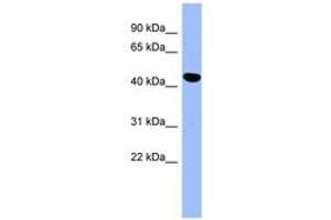 Image no. 1 for anti-Plasminogen Activator Inhibitor 1 (SERPINE1) (AA 251-300) antibody (ABIN6741811) (PAI1 antibody  (AA 251-300))