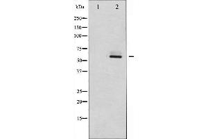 Western blot analysis of Fyn expression in 293 whole cell lysates,The lane on the left is treated with the antigen-specific peptide. (FYN antibody  (C-Term))