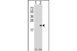 Western blot analysis of RFK (arrow) using rabbit polyclonal RFK Antibody (C15) (ABIN391271 and ABIN2841321). (Riboflavin Kinase antibody  (N-Term))