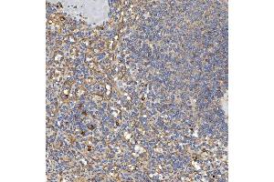 IHC analysis of TXNDC5 using anti-TXNDC5 antibody (ABIN7599699). (TXNDC5 antibody  (AA 109-403))