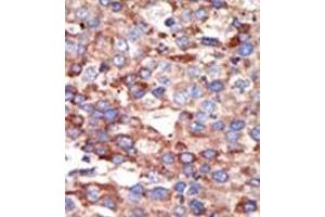 Image no. 2 for anti-YY1 Transcription Factor (YY1) (Middle Region) antibody (ABIN357757) (YY1 antibody  (Middle Region))