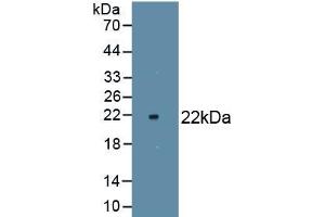 Detection of Recombinant NOS2, Rat using Monoclonal Antibody to Nitric Oxide Synthase 2, Inducible (NOS2) (NOS2 antibody  (AA 518-694))