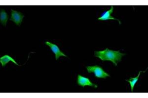 Immunofluorescence staining of SY5Y Cells with ABIN7127838 at 1:50, counter-stained with DAPI. (Recombinant TPT1 antibody)