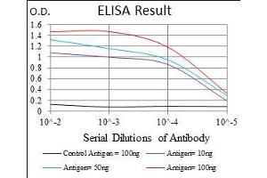 Black line: Control Antigen (100 ng), Purple line: Antigen(10 ng), Blue line: Antigen (50 ng), Red line: Antigen (100 ng), (MCAM antibody  (AA 84-189))