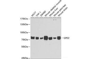 Western blot analysis of extracts of various cell lines using GPD2 Polyclonal Antibody at dilution of 1:1000. (GPD2 antibody)