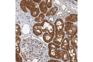 Immunohistochemical staining of human kidney with FBXO43 polyclonal antibody  shows distinct cytoplasmic positivity in cells in tubules.