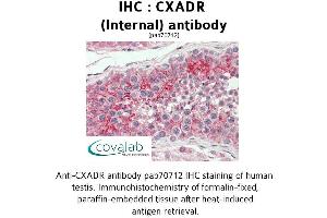 Image no. 2 for anti-Coxsackie Virus and Adenovirus Receptor (CXADR) (Internal Region) antibody (ABIN1733389) (Coxsackie Adenovirus Receptor antibody  (Internal Region))