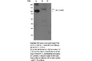 10% SDS-PAGE stained with Coomassie Blue, immunoblot with anti-KAL1 monoclonal and peptide fingerprinting by MALDI-TOF (Human KAL1 Overexpression lysate product)