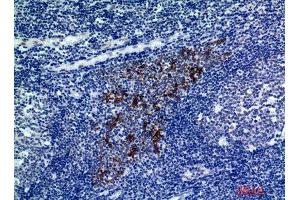 Immunohistochemistry (IHC) analysis of paraffin-embedded Human Tonsils, antibody was diluted at 1:200. (CMTM8 antibody)